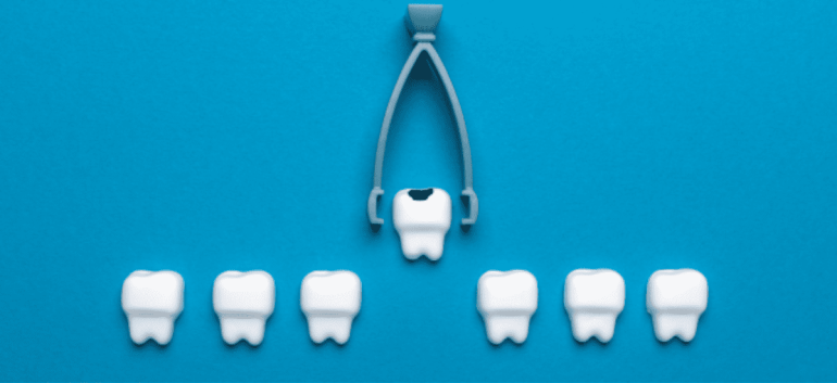 1．不必要な抜歯から歯を守る：保守的な治療方針の尊重